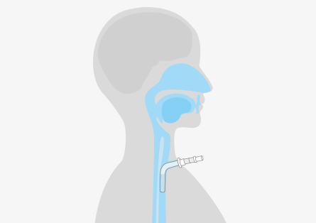 Symbolbild Intensivpflege